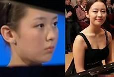 吉娜整容