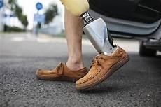 截肢多少钱